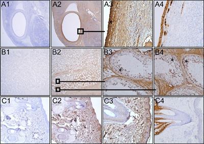 Inadequate detection of the FSHR complicates future research on extragonadal FSHR localization